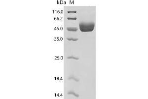 (Tris-Glycine gel) Discontinuous SDS-PAGE (reduced) with 5 % enrichment gel and 15 % separation gel.