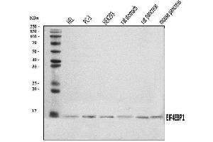Western blot analysis of EIF4EBP1 using anti-EIF4EBP1 antibody (ABIN7602881).