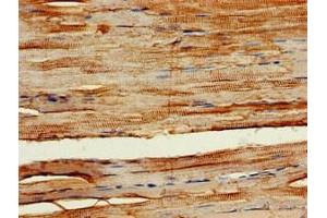 Immunohistochemistry of paraffin-embedded human skeletal muscle tissue using ABIN7163159 at dilution of 1:100