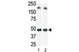 The SphK1 antibody used in western blot (lane 2) to detect c-myc-tagged SphK1 in transfected 293 cell lysate (a c-myc antibody is used as control in Lane 1). (SPHK1 anticorps  (AA 1-30))