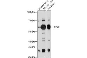 Western blot analysis of extracts of various cell lines, using RIPK2 antibody (ABIN3023312, ABIN3023313, ABIN3023314 and ABIN6219574) at 1:1000 dilution. (RIPK2 anticorps  (AA 1-540))