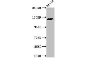 Western Blot Positive WB detected in: Mouse brain tissue All lanes: MYRF antibody at 3. (Chromosome 11open Reading Frame 9 (C11orf9) (AA 843-1004) anticorps)