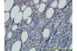 Image no. 1 for anti-RAP2B, Member of RAS Oncogene Family (RAP2B) (AA 1-184) antibody (ABIN598571) (RAP2B anticorps  (AA 1-184))