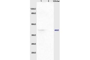 Lane 1: mouse embryo lysates Lane 2: mouse spleen lysates probed with Anti CCR9 Polyclonal Antibody, Unconjugated at 1:200 in 4 ˚C. (CCR9 anticorps  (AA 65-160))