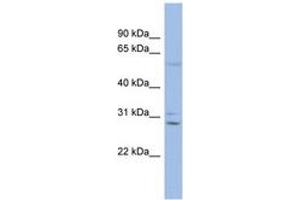 Image no. 1 for anti-Gap Junction Protein, beta 6, 30kDa (GJB6) (C-Term) antibody (ABIN6742704) (GJB6 anticorps  (C-Term))