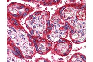 Anti-WNT3A antibody IHC of human placenta.