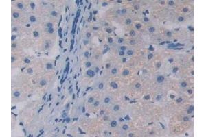 Detection of APOA5 in Human Liver Tissue using Polyclonal Antibody to Apolipoprotein A5 (APOA5) (APOA5 anticorps  (AA 167-335))