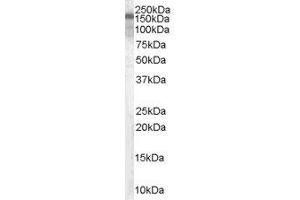 ABIN2562994 (0. (TSC1 anticorps  (C-Term, Isoform 1))