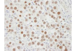 Immunohistochemistry (IHC) image for anti-Minichromosome Maintenance Complex Component 5 (MCM5) (AA 1-50) antibody (ABIN7448655)