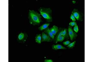 Immunofluorescence staining of A549 cells with ABIN7144485 at 1:166, counter-stained with DAPI. (APAF1 anticorps  (AA 104-415))
