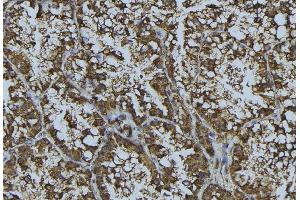 ABIN6268857 at 1/100 staining Mouse testis tissue by IHC-P. (CRHR1 anticorps  (Internal Region))