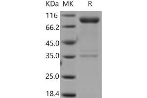 Western Blotting (WB) image for Interleukin 1 Receptor, Type I (IL1R1) (Active) protein (His tag,Fc Tag) (ABIN7321236)