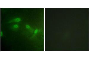 Immunofluorescence staining of methanol-fixed HeLa cells using MDM2 (Phospho-Ser186/Ser188) Antibody.