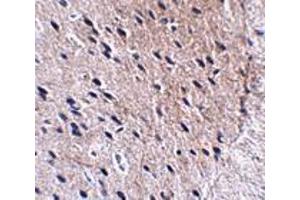 Immunohistochemistry of Bora in mouse brain tissue with Bora antibody at 2.