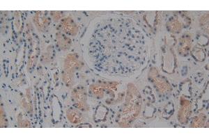 Detection of C1QBP in Human Kidney Tissue using Polyclonal Antibody to Complement component 1 Q subcomponent-binding protein, mitochondrial (C1QBP)