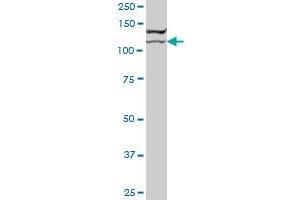 BCOR MaxPab polyclonal antibody. (BCOR anticorps  (AA 1-1004))