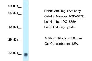 WB Suggested Anti-Tagln Antibody Titration:  1 ug/ml  Positive Control:  Rat Lung lysate (Transgelin anticorps  (C-Term))