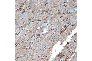 Immunohistochemistry of paraffin-embedded rat heart using Creatine kinase B type (CKB) Rabbit mAb (ABIN7266515) at dilution of 1:100 (40x lens). (CKB anticorps)