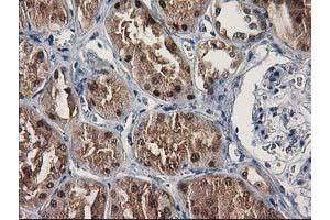 Immunohistochemical staining of paraffin-embedded Human Kidney tissue using anti-SULT1C2 mouse monoclonal antibody. (SULT1C2 anticorps)