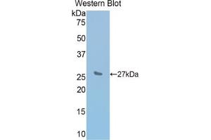 Western blot analysis of the recombinant protein. (IL2 Receptor beta anticorps  (AA 27-240))