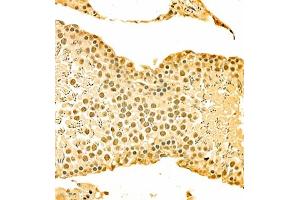 Immunohistochemistry of paraffin embedded rat testis using HOXC9 (ABIN7074251) at dilution of 1:700 (300x lens) (HOXC9 anticorps)