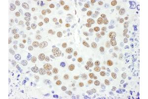 Immunohistochemistry (IHC) image for anti-Myocyte Enhancer Factor 2D (MEF2D) (AA 475-521) antibody (ABIN7453637)
