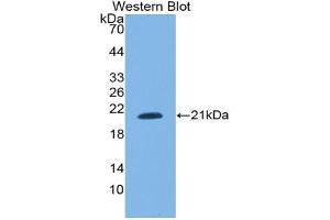 Western blot analysis of the recombinant protein. (SNRPC anticorps  (AA 2-159))