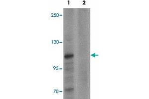 Western blot analysis of ZMIZ1 in K-562 cell lysate with ZMIZ1 polyclonal antibody  at 0. (ZMIZ1 anticorps  (N-Term))