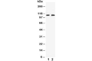 Western blot testing of EphB3 antibody and Lane 1:  HeLa (EPH Receptor B3 anticorps  (C-Term))