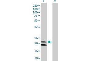 Western Blot analysis of IFNA4 expression in transfected 293T cell line by IFNA4 MaxPab polyclonal antibody.