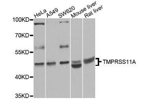 Western blot analysis of extracts of various cell lines, using TMPRSS11A antibody (ABIN5995991) at 1/1000 dilution.