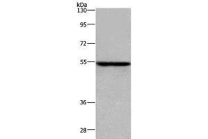 Western Blot analysis of MCF-7 cell using ETS2 Polyclonal Antibody at dilution of 1:300 (ETS2 anticorps)