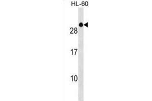 Western Blotting (WB) image for anti-Transcription Elongation Factor A (SII)-Like 2 (TCEAL2) antibody (ABIN3000105)