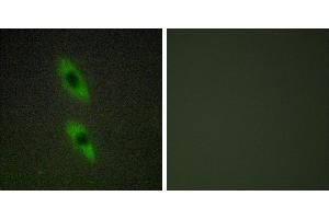 Peptide - +Immunohistochemistry analysis of paraffin-embedded human liver carcinoma tissue using FADD antibody. (FADD anticorps)