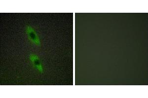 Peptide - +Immunohistochemistry analysis of paraffin-embedded human liver carcinoma tissue using FADD antibody. (FADD anticorps)