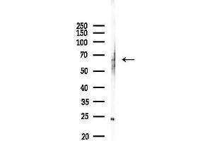 anti-TBC1 Domain Family, Member 24 (TBC1D24) antibody
