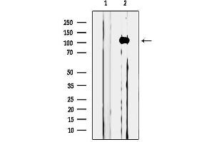 anti-Microtubule Associated Monoxygenase, Calponin and LIM Domain Containing 1 (MICAL1) (Internal Region) antibody