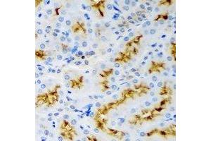 Immunohistochemical analysis of p43 staining in rat kidney formalin fixed paraffin embedded tissue section. (p43 anticorps)