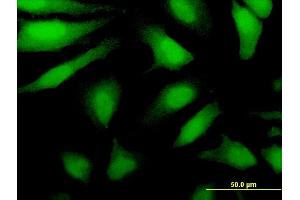 Immunofluorescence of monoclonal antibody to DDX43 on HeLa cell.