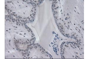 Immunohistochemical staining of paraffin-embedded breast using anti-IL-3 (ABIN2452543) mouse monoclonal antibody. (IL-3 anticorps  (AA 20-152))