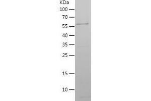 Annexin A5 (ANXA5) (AA 1-319) protein (His-EGFP Tag)