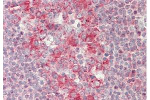 anti-Rap Guanine Nucleotide Exchange Factor (GEF) 1 (RAPGEF1) (C-Term) antibody