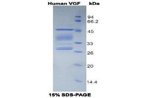 SDS-PAGE (SDS) image for VGF Nerve Growth Factor Inducible (VGF) (AA 330-449) protein (His tag,GST tag) (ABIN1099334) (VGF Protein (AA 330-449) (His tag,GST tag))