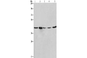 Western Blotting (WB) image for anti-Ribosomal Protein SA (RPSA) antibody (ABIN2421848) (RPSA/Laminin Receptor anticorps)