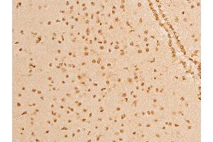 ABIN6267232 at 1/100 staining mouse brain tissue sections by IHC-P.