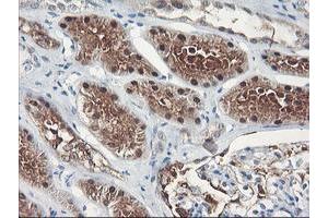 Immunohistochemical staining of paraffin-embedded Human Kidney tissue using anti-FBXO21 mouse monoclonal antibody. (FBXO21 anticorps)