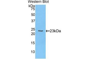 Detection of Recombinant CBX3, Human using Polyclonal Antibody to Chromobox Homolog 3 (CBX3) (CBX3 anticorps  (AA 1-183))