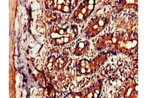 Immunohistochemistry of paraffin-embedded human small intestine tissue using ABIN7147277 at dilution of 1:100