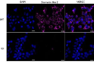 Immunocytochemical staining of HeLa cells using Stomatin like 2 antibody (ABIN7800442), 1:1,000), Top panel: wild-type (WT), Bottom panal: Stomatin like 2 shRNA knockdown (KD). (Recombinant STOML2 anticorps)