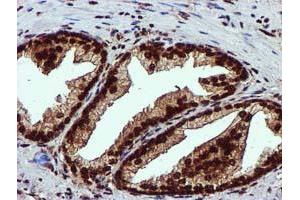 Image no. 3 for anti-EPM2A (Laforin) Interacting Protein 1 (EPM2AIP1) antibody (ABIN1498045) (EPM2AIP1 anticorps)